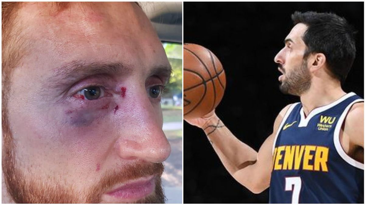 Campazzo estalla tras ver la brutal paliza que recibió un jugador de baloncesto: "Repudio por completo la agresión"