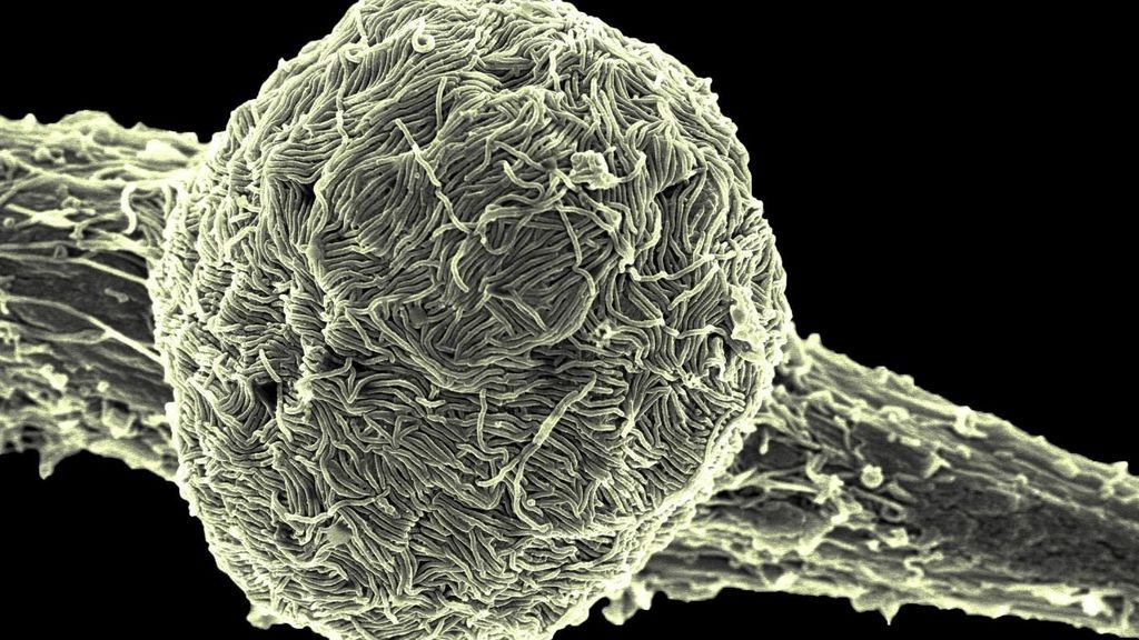 Sorpresa científica: un superviviente del ébola contagia el virus cinco años después de su infección