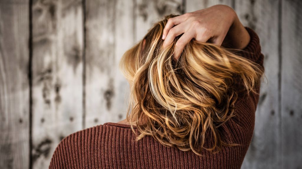 Alopecia femenina, uno de los mayores tabús estéticos