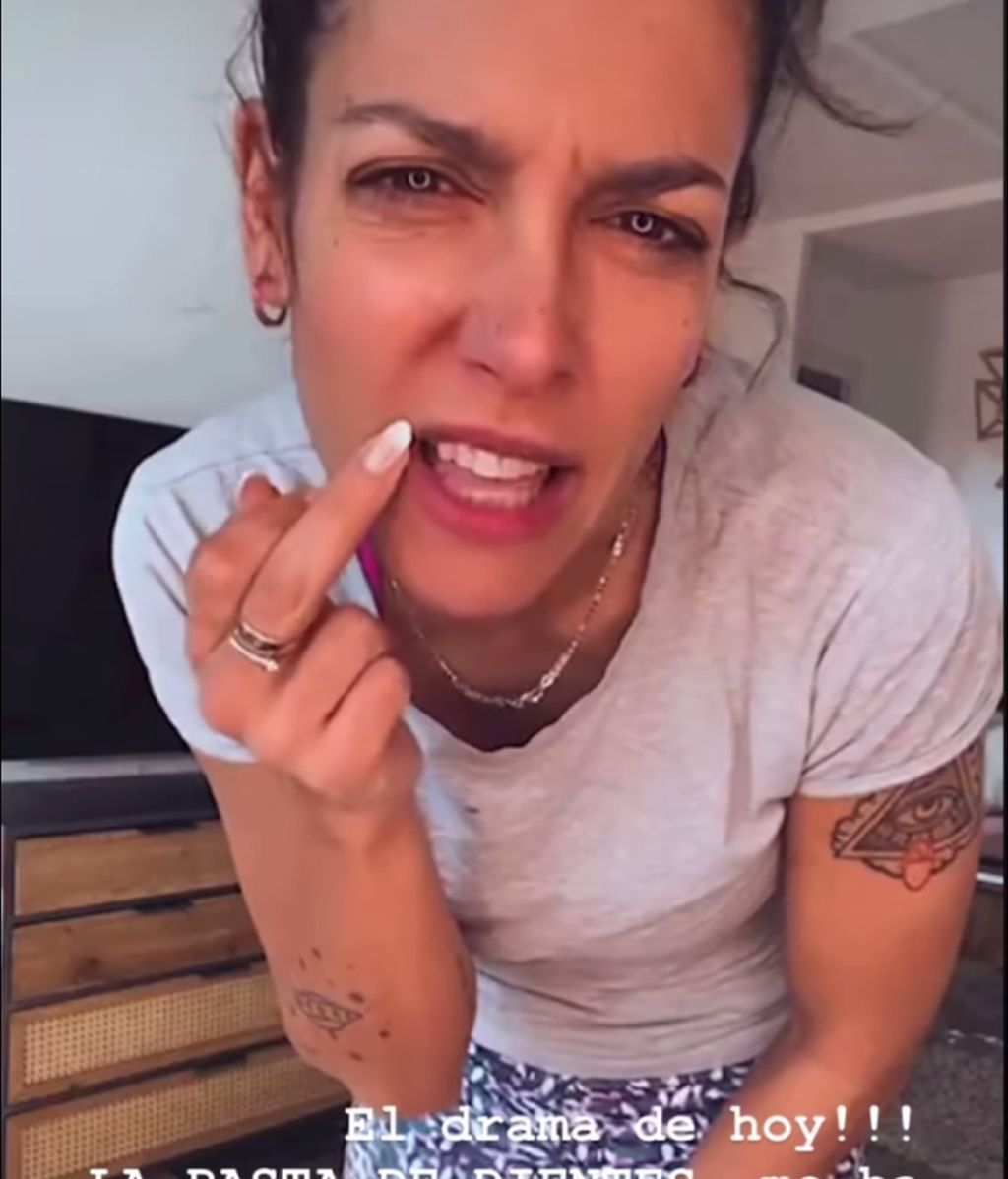La quemadura en la cara de Lorena Castell