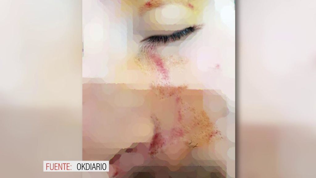 La brutales declaraciones del funcionario de prisiones agredido