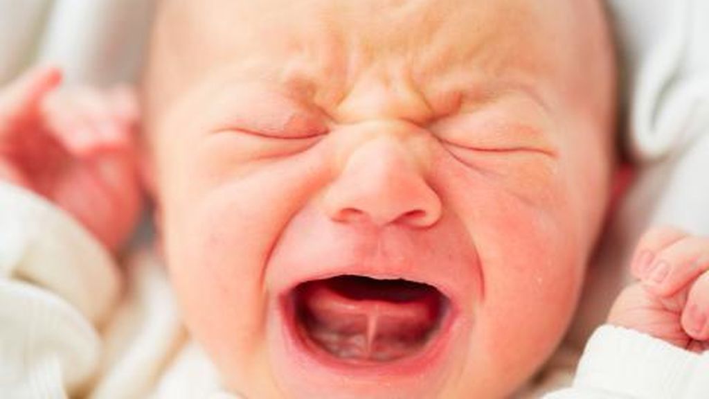Para saber si el pequeño tiene el frenillo corto habrá que tener en cuenta sus signos.