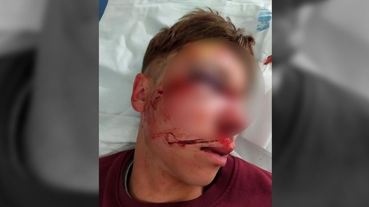 Detenido un joven por pegar con un ladrillo en la cara a otro en una calle de Parla, en Madrid Detenido un joven por pegar con un ladrillo en la cara a otro en una calle de Parla, en Madrid