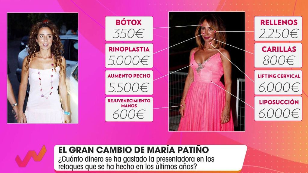 María Patiño y su gran cambio físico