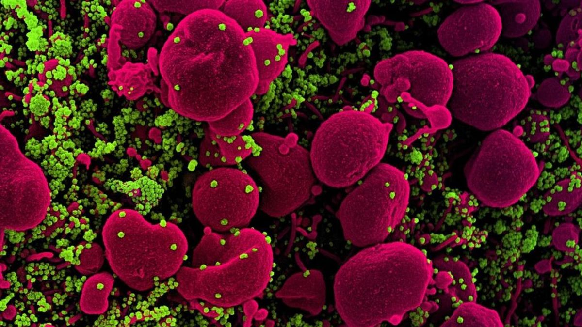 Los científicos creen que el coronavirus se convertirá en un virus endémico, como la gripe Los científicos creen que el coronavirus se convertirá en un virus endémico, como la gripe
