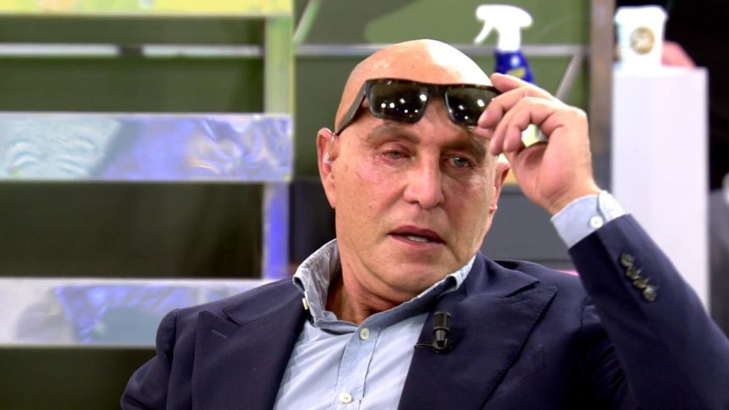 Kiko Matamoros, con gafas de sol en plató por un problema ocular: "Creo que es una úlcera"