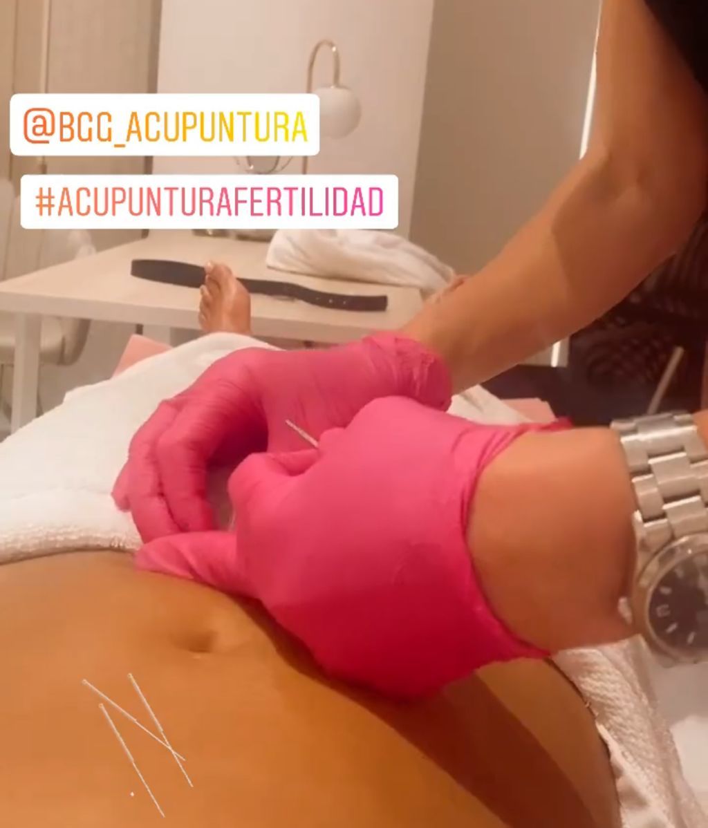 Vania Millán, durante su tratamiento de acupuntura