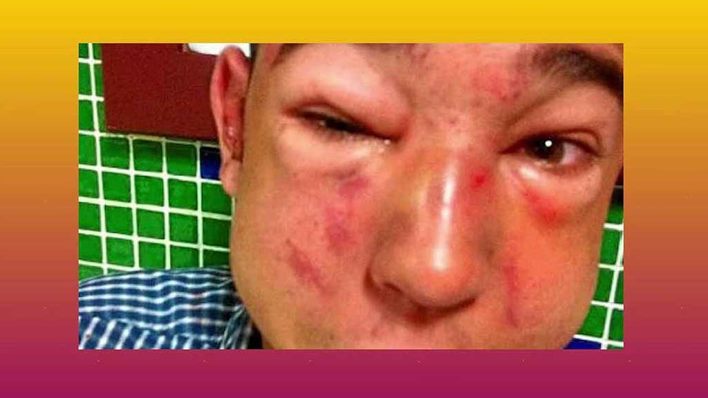 Omar Sánchez, novio de Anabel Pantoja, sufrió una brutal paliza en la que le perforaron el tímpano y le rompieron la nariz