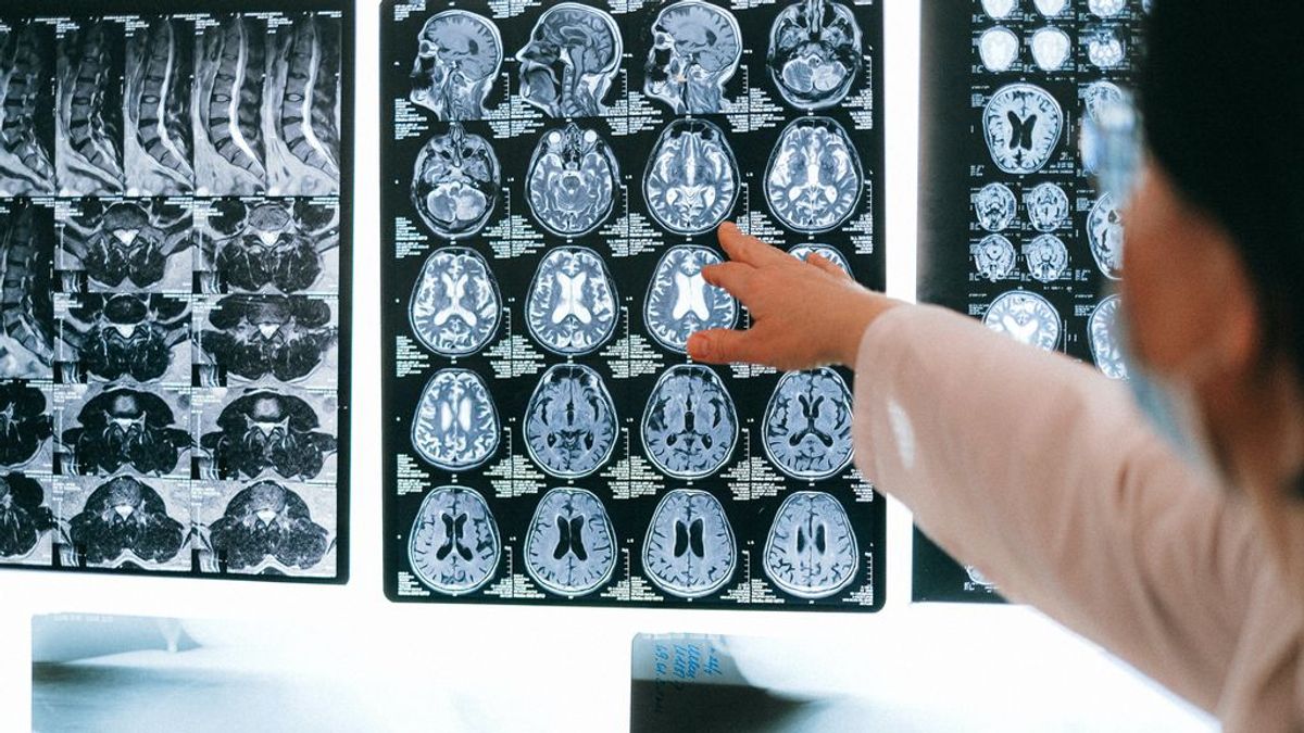 Cinco cosas que deberías saber sobre la Meningitis Cinco cosas que deberías saber sobre la Meningitis