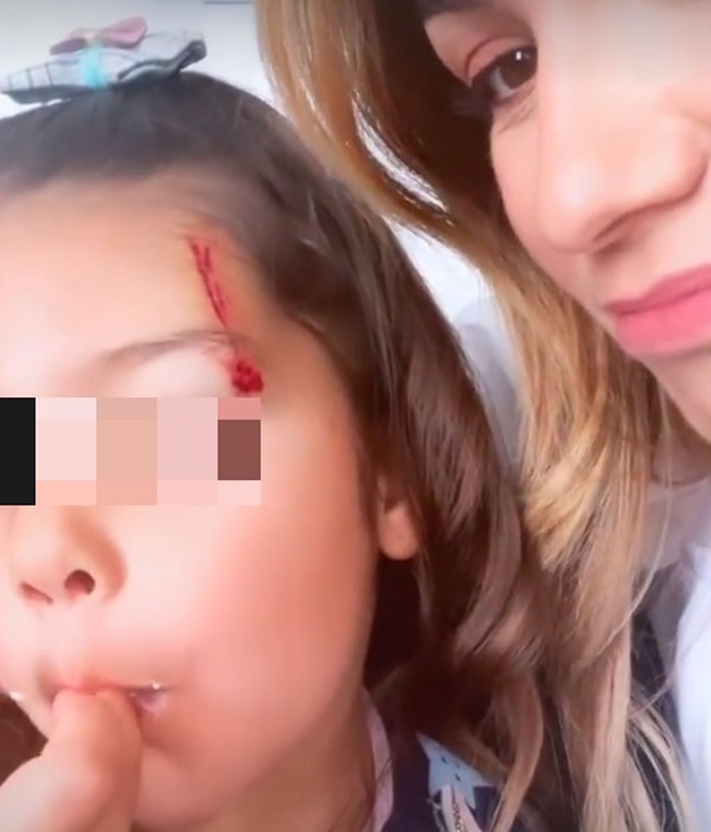 El golpe en la cara de Shaila Garay Gorro