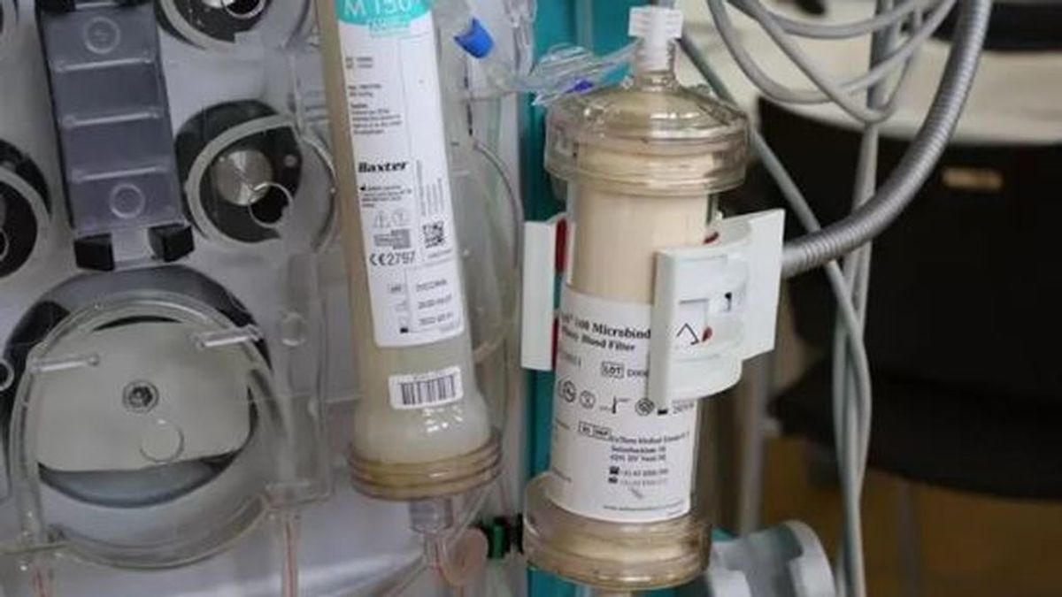 Prueban un filtro que puede eliminar el covid de la sangre de pacientes infectados