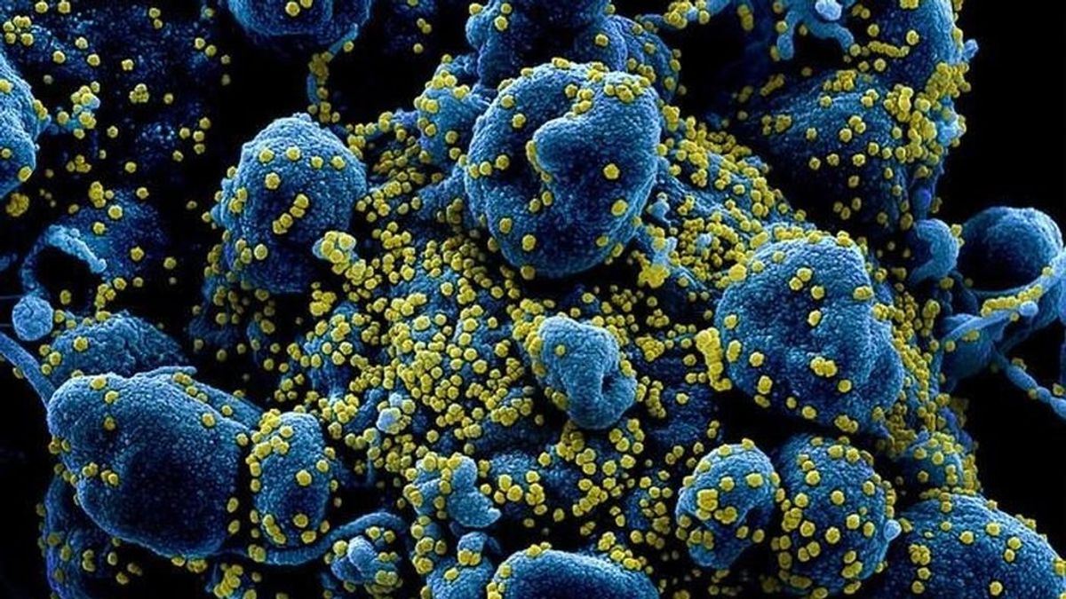 La vacuna contra todos los coronavirus da el primer paso: un proyecto logra proteger a animales La vacuna contra todos los coronavirus da el primer paso: un proyecto logra proteger a animales