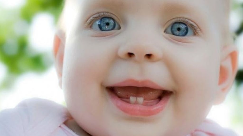 Los niños podrán desarrollar dientes natales o neonatales.