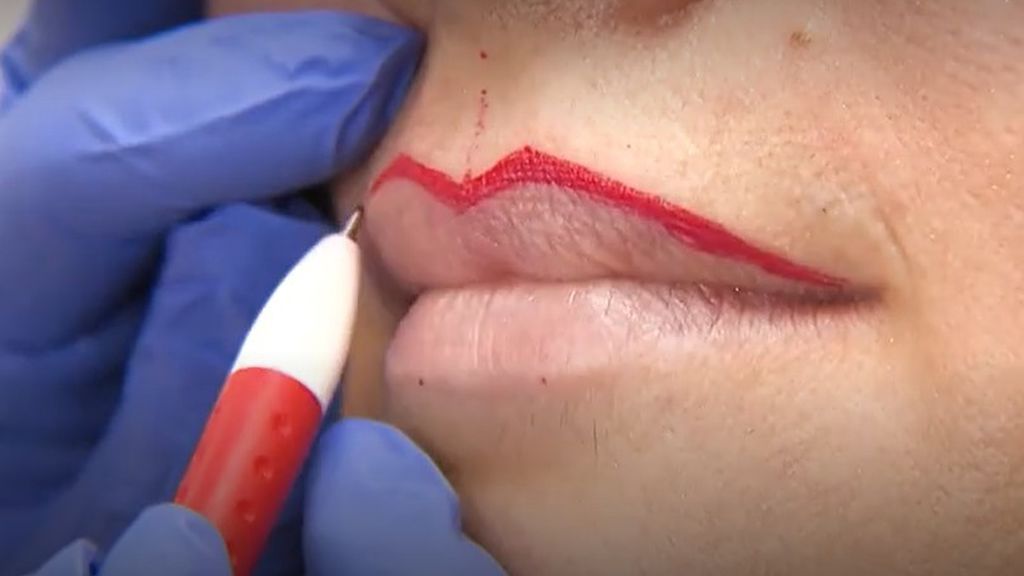 Pigmentación permanente de labios