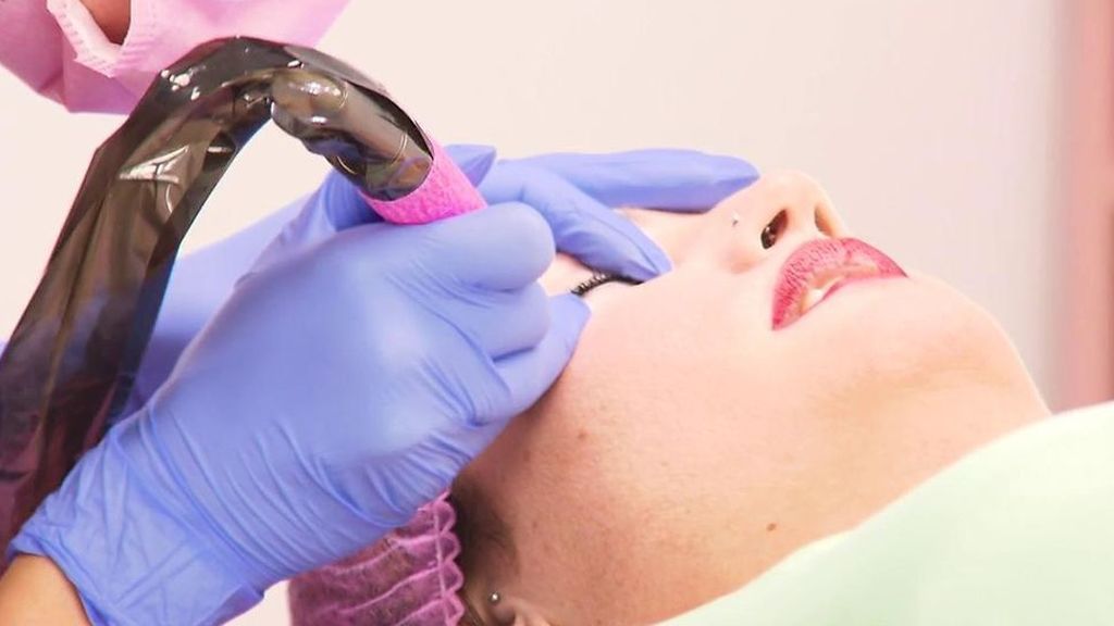 Proceso de micropigmentación