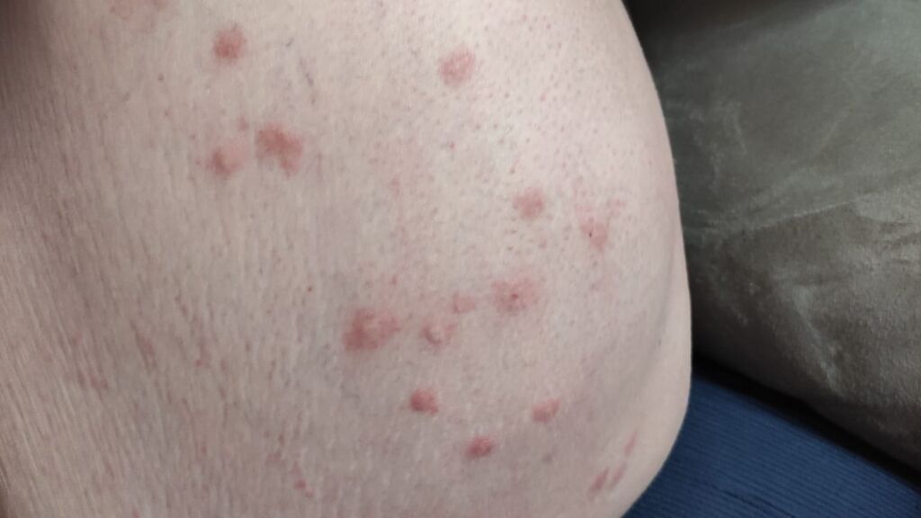 SOS vecinos de Córdoba por los mosquitos