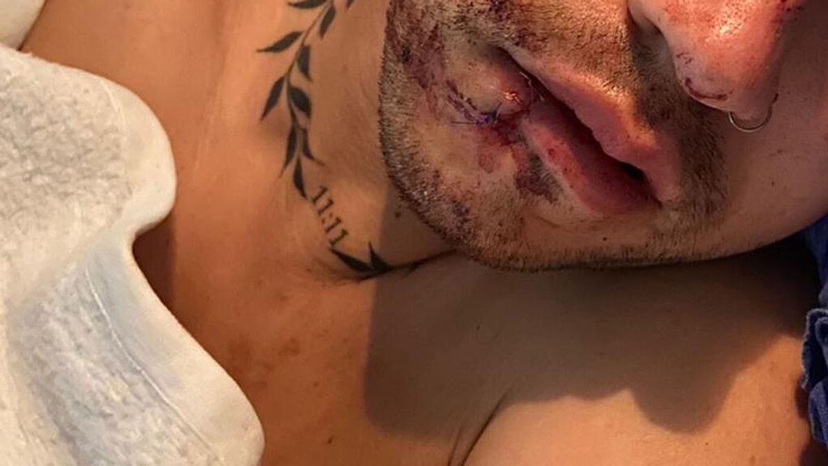 Condenan tres agresiones homófobas en Barcelona durante el fin de semana Condenan tres agresiones homófobas en Barcelona durante el fin de semana