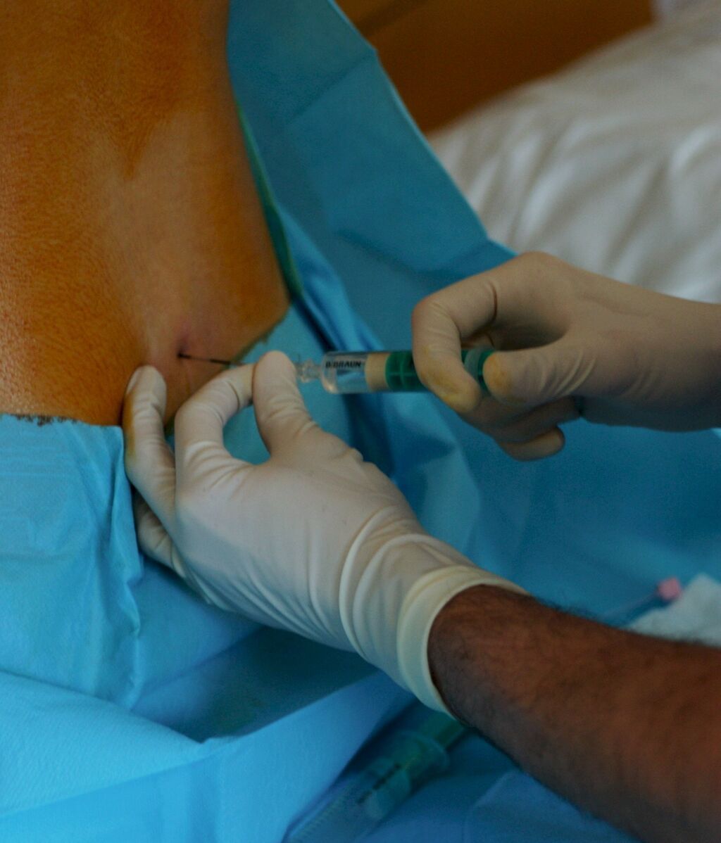 EPIDURAL.CORDONPRESS