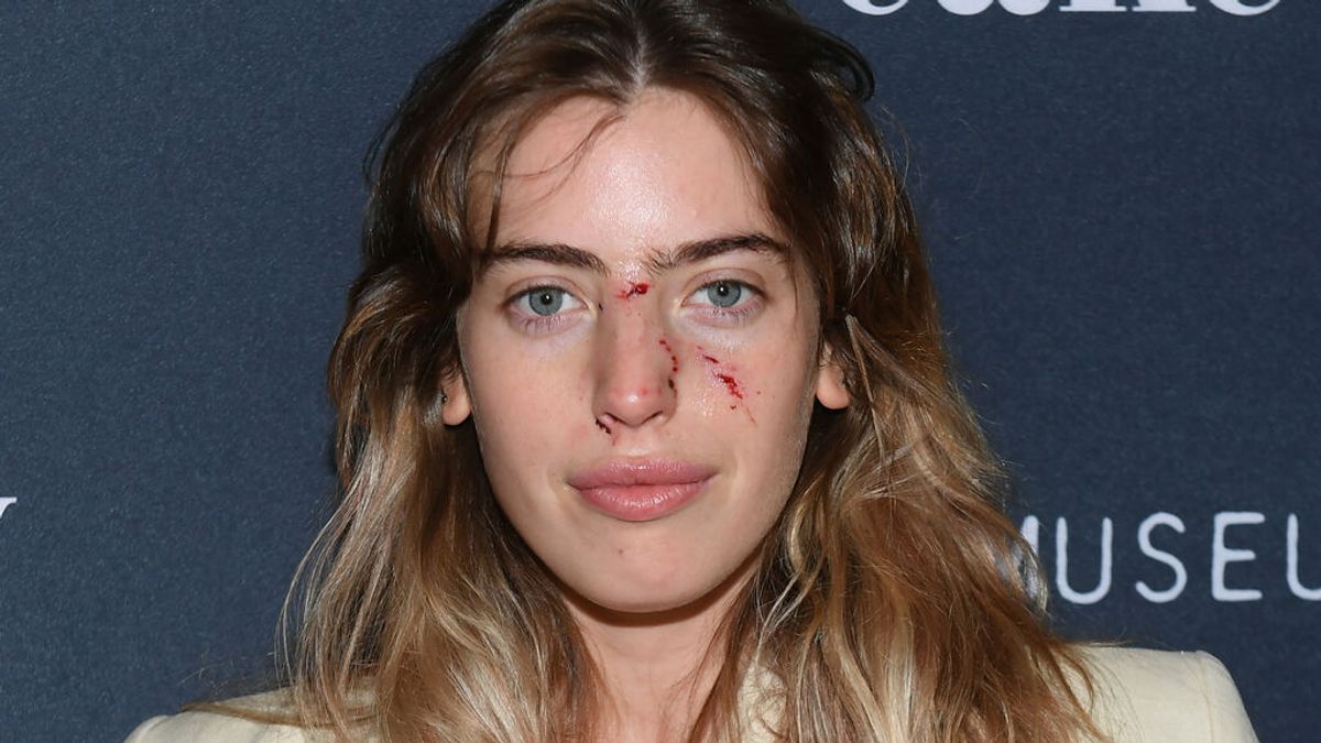 Clara, hija Ewan McGregor, posó en un estreno del actor con la cara recién mordida por un perro Clara, hija Ewan McGregor, posó en un estreno del actor con la cara recién mordida por un perro