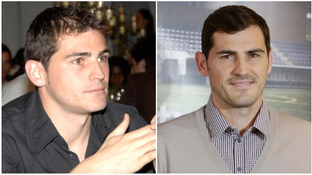 Iker Casillas también decidió pasar por quirófano.