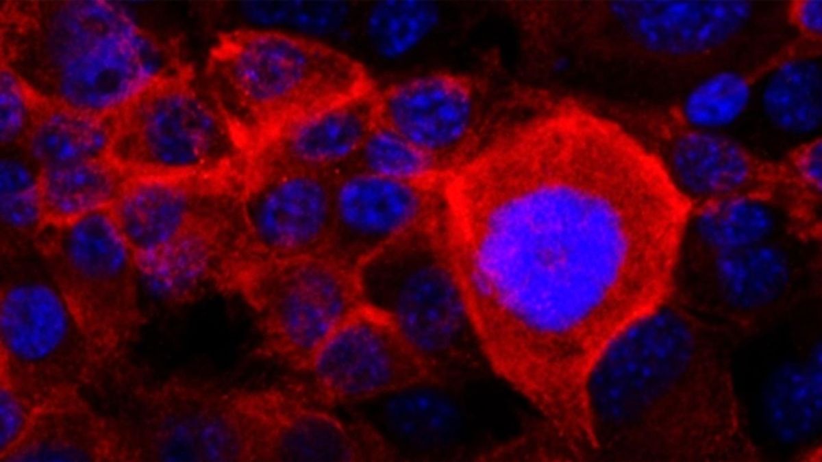 Investigadores explican cómo las células del cáncer de páncreas esquivan los tratamientos