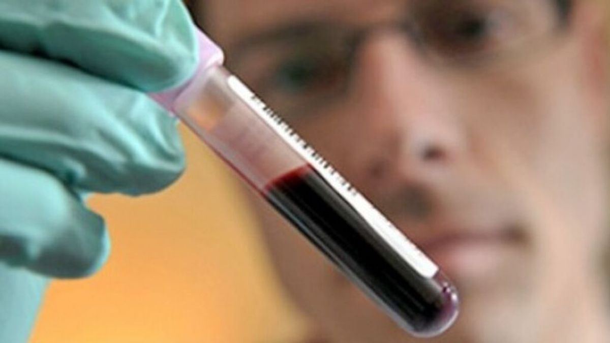 Desarrollan un análisis de sangre capaz de detectar más de 50 tipos de cáncer