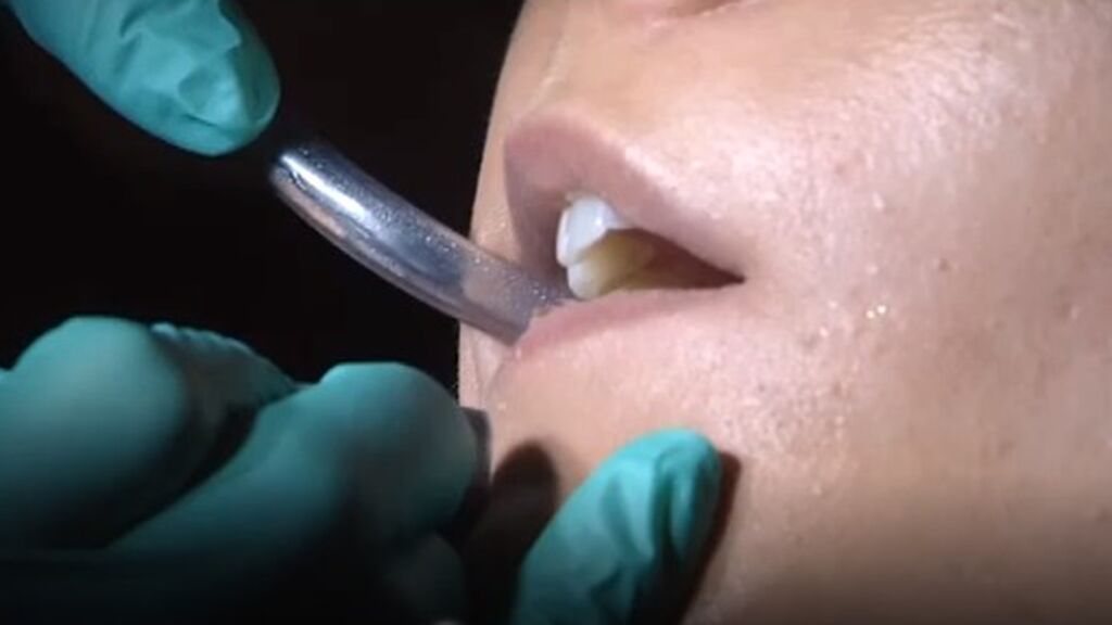 El fin de la mascarilla en exteriores dispara las visitas a odontólogos y perfumerías