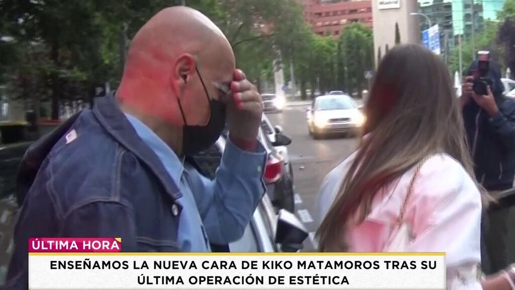 Kiko Matamoros intenta ocultar su nuevo rostro