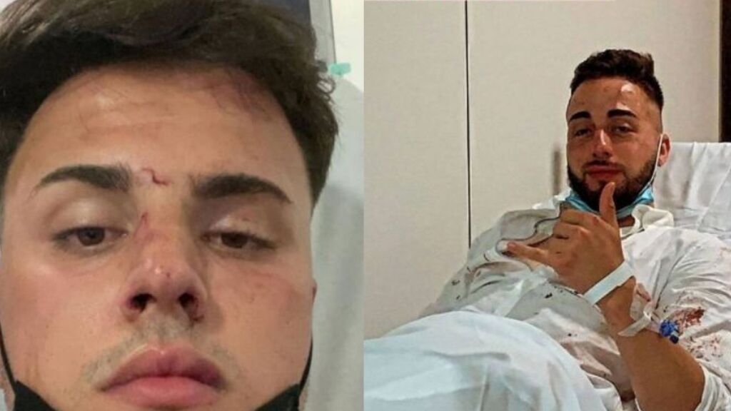 Agresión a las puertas de una discoteca en Barcelona