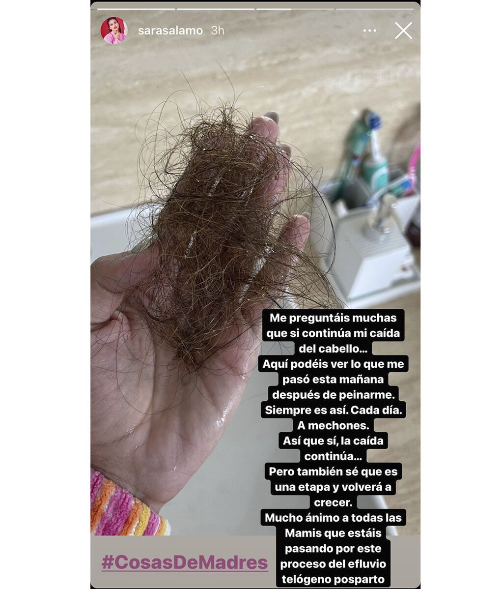 Sara Sálamo visibiliza su caída de pelo posparto