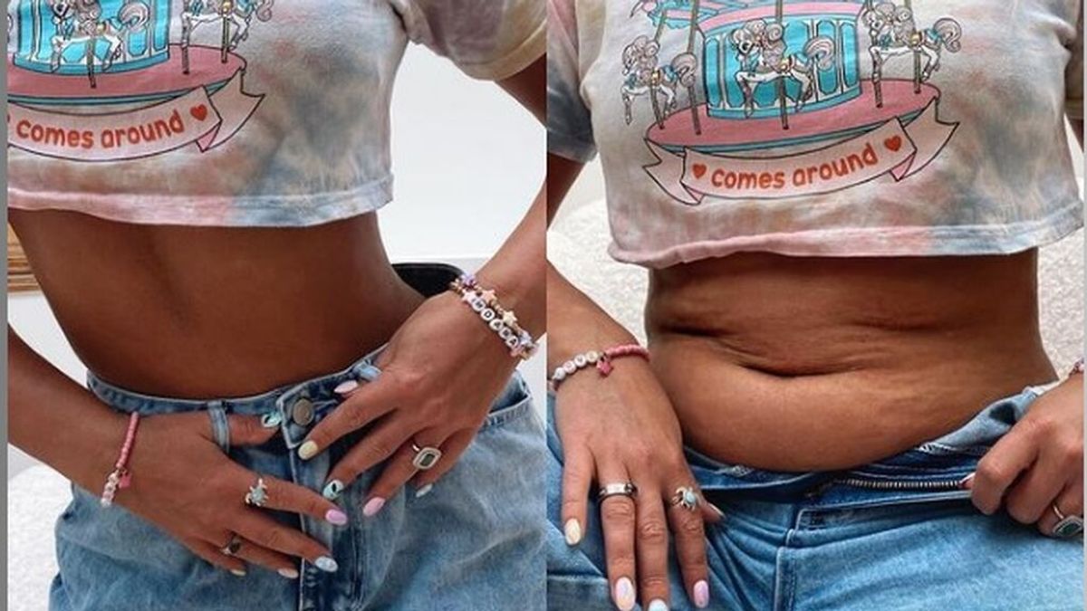 Una mujer comparte la diferencia entre sus fotos posando y sin posar para lanzar un mensaje de 'body positive'