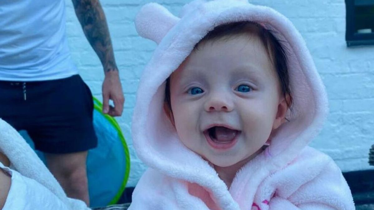 Lexi Robins, una bebé de cinco meses que sufre la enfermedad del hombre de piedra