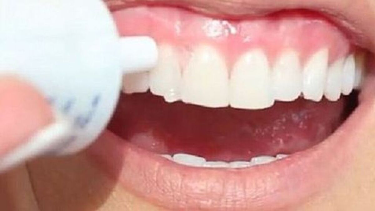 La OCU de la presencia de una sustancia corrosiva en algunos blanqueadores dentales