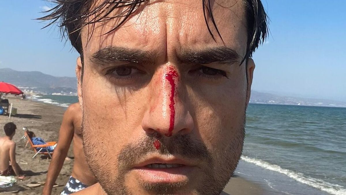 Denuncia una agresión homófoba en una playa canina de Málaga: "Acércate maricón, que te voy a matar" Denuncia una agresión homófoba en una playa canina de Málaga: "Acércate maricón, que te voy a matar"