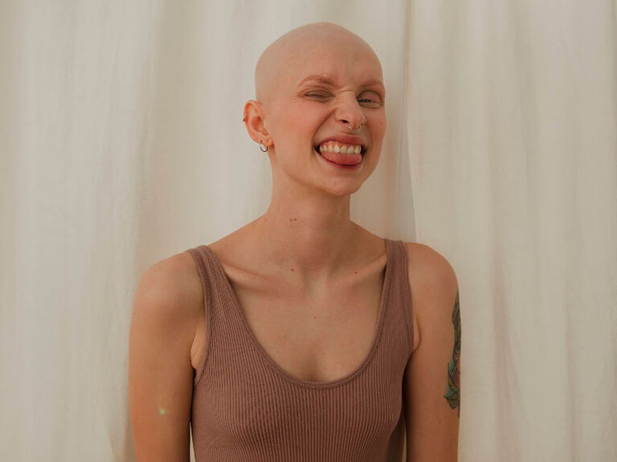 Estela, la chica que visibilizó la alopecia en First Dates-Yasss