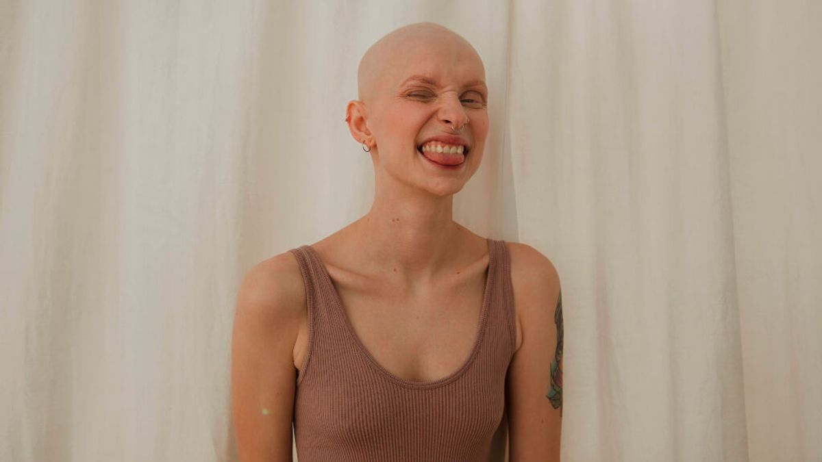 Estela visibiliza la alopecia femenina con humor