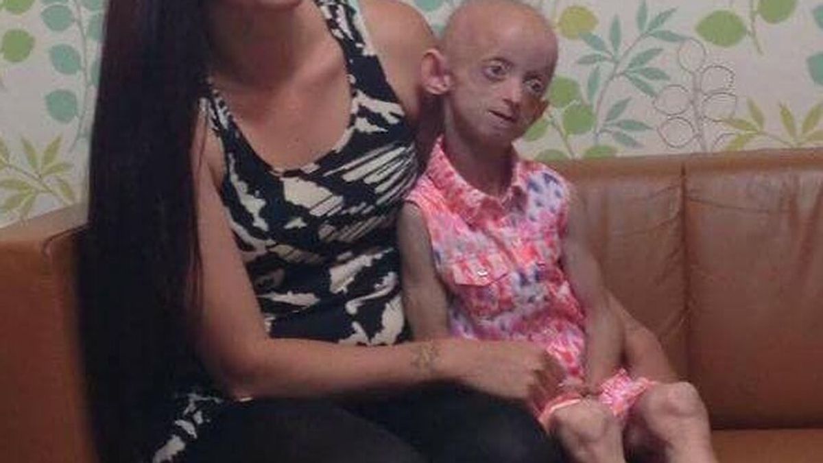Ashanti Smith, de 18 años, muere con el aspecto de una anciana de 144 a causa de la progeria, una rara enfermedad