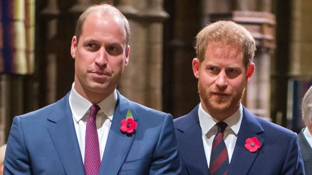 Harry y William han heredado el poco pelo de su padre.