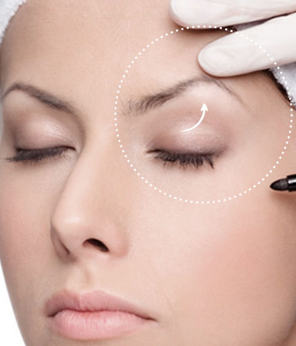 4_ FOX EYES elevacion-cola-de-ceja-1