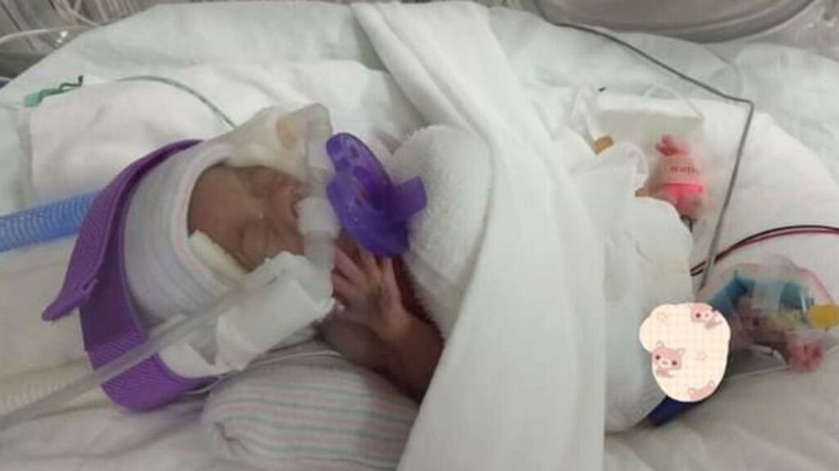 Recibe el alta la bebé prematura más pequeña del mundo tras 13 meses en el hospital Recibe el alta la bebé prematura más pequeña del mundo tras 13 meses en el hospital