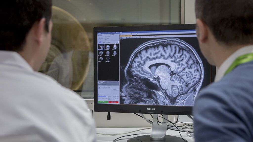 Aducanumab, el primer fármaco aprobado contra el Alzheimer en 20 años: cuándo llegará a España