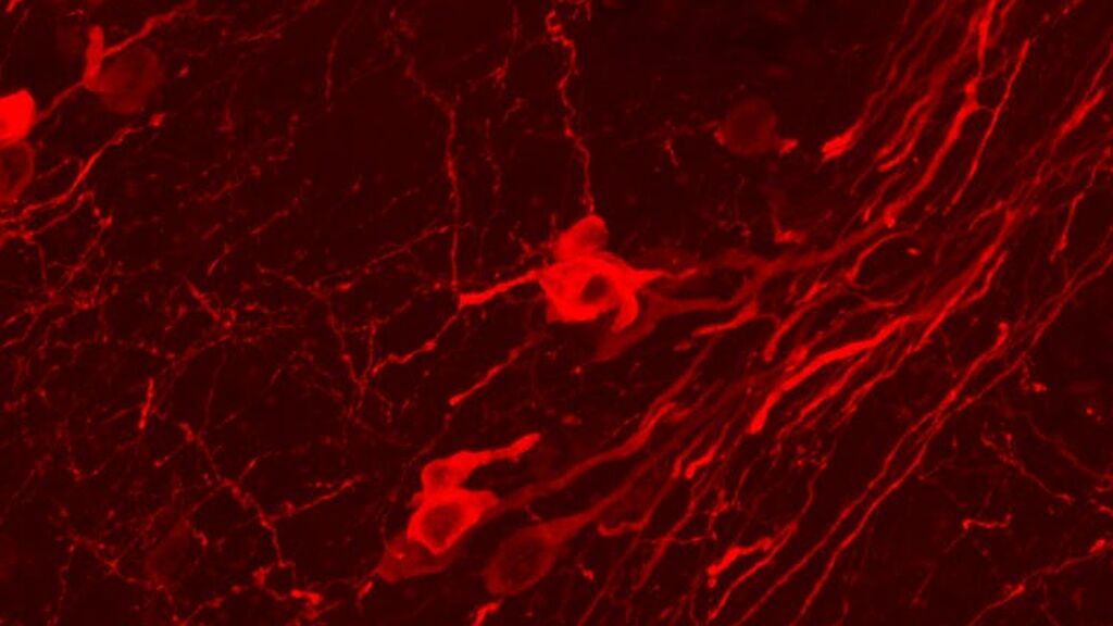 Microfotografía de neuronas de la sustancia negra, que liberan dopamina ante novedades y recompensas generando una situación placentera