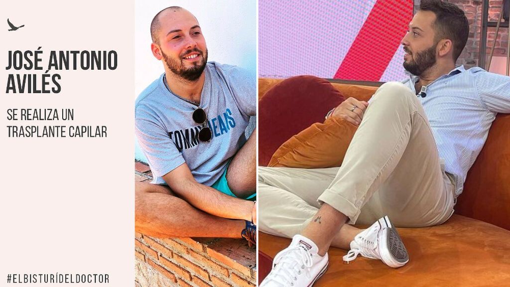 José Antonio Avilés luce cabellera poblada y nuevo tupé tras su injerto capilar