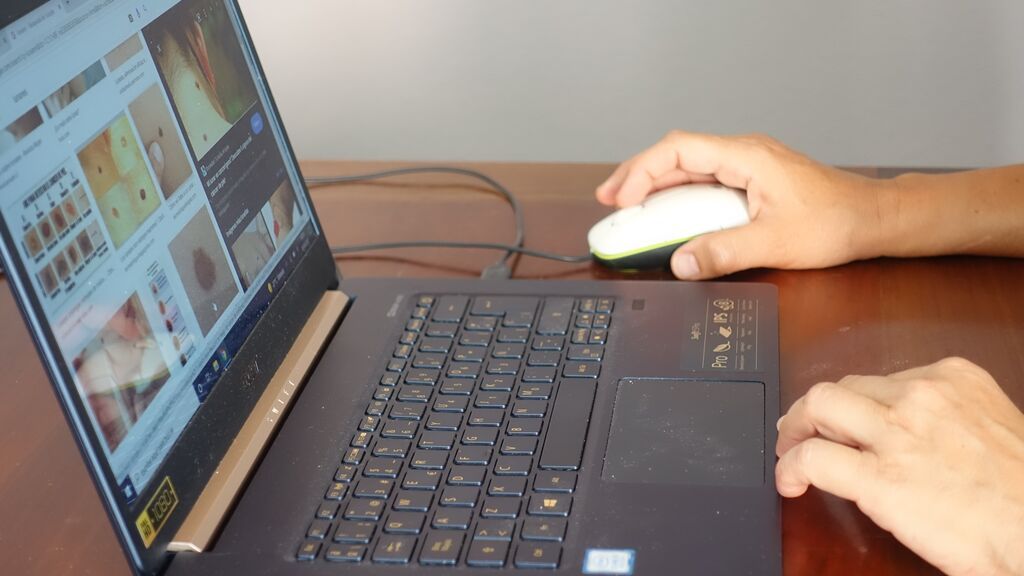 Una persona consulta sobre dermatología en un ordenador