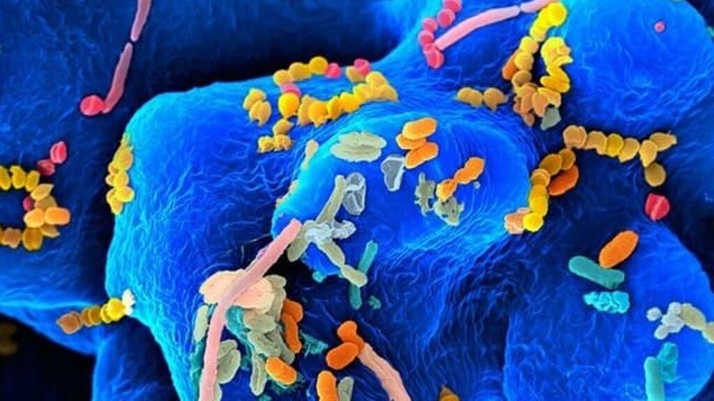 El abuso de los antibióticos aumenta el riesgo de padecer cáncer de colon