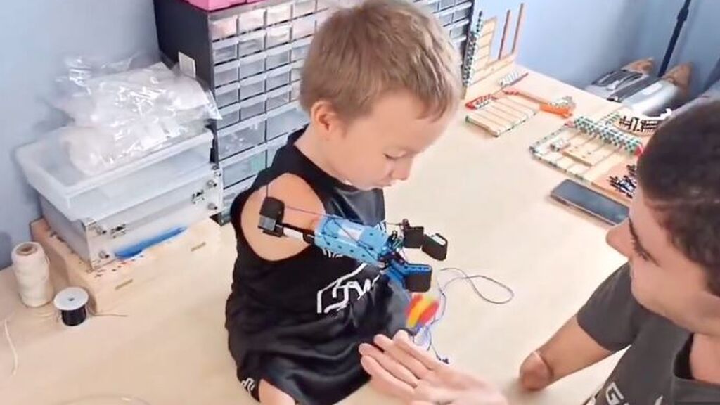 David cambia la vida de Beknur: Le fabrica una prótesis de  brazo con piezas de lego