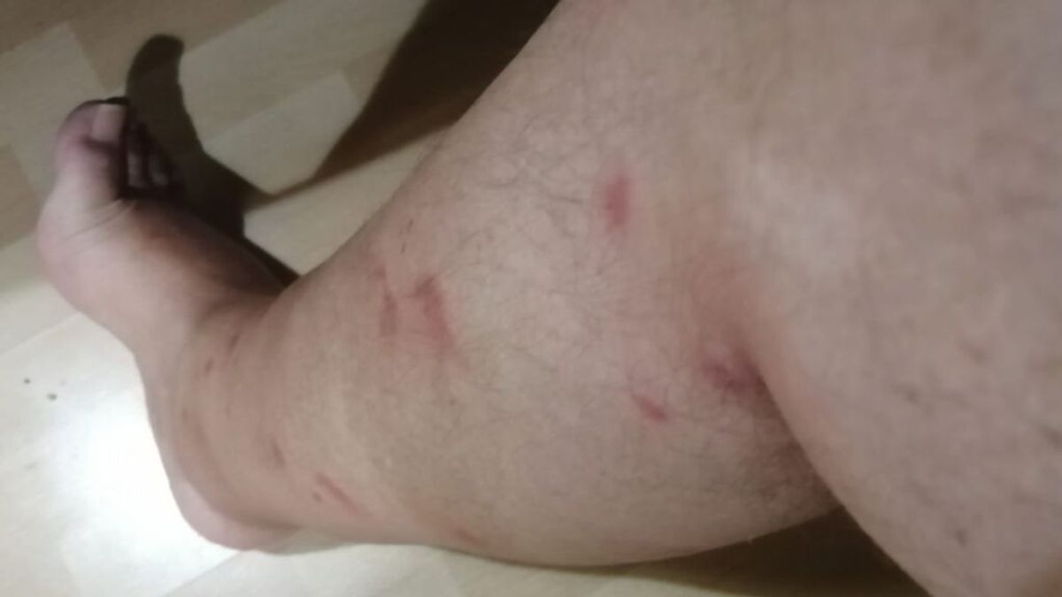 Esto es mosquilandia: los vecinos del Grau de Castellón no pueden más Esto es mosquilandia: los vecinos del Grau de Castellón no pueden más