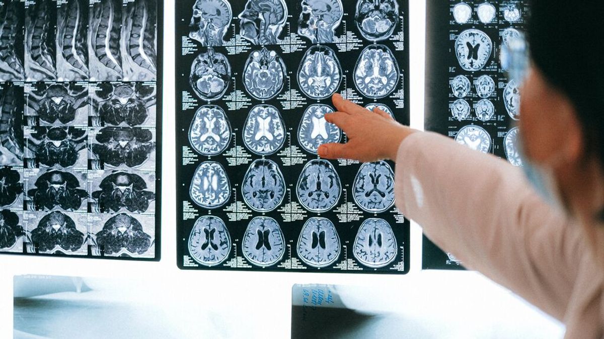 ¿Por qué fracasan todos los fármacos contra el alzhéimer? ¿Por qué fracasan todos los fármacos contra el alzhéimer?