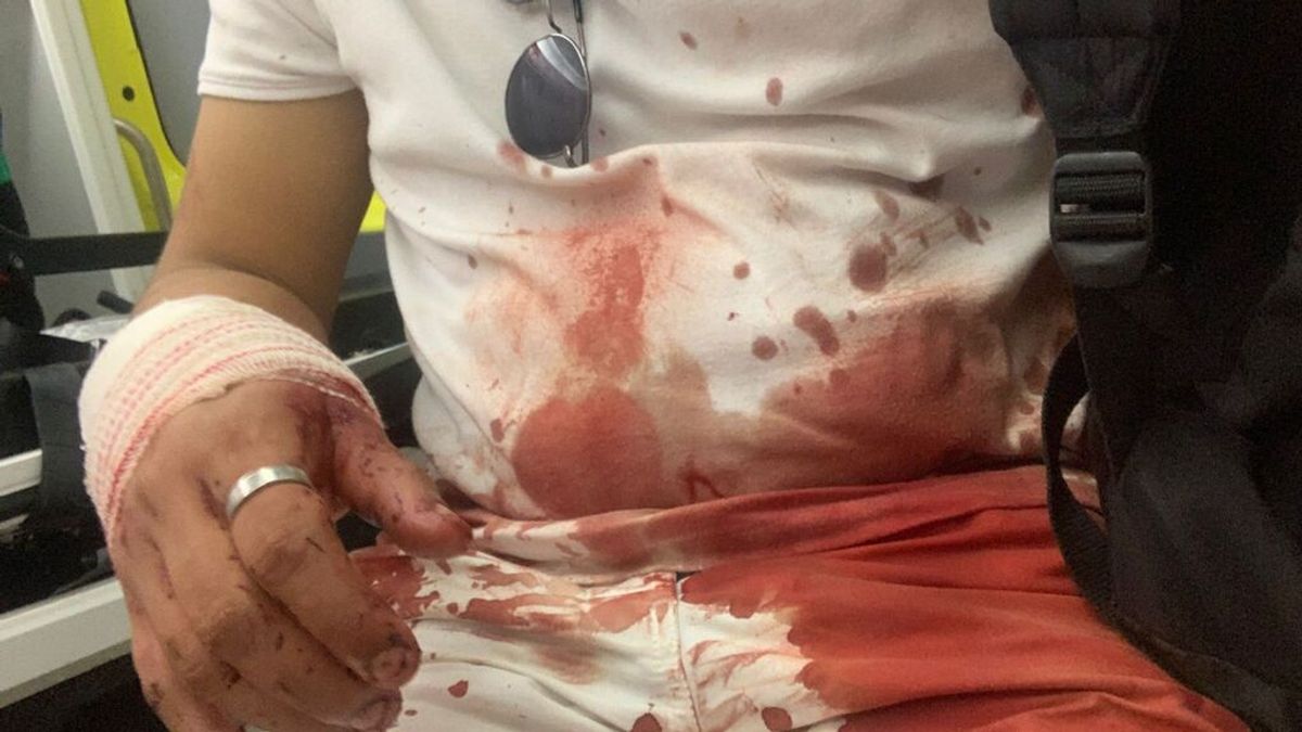 Un joven denuncia una agresión homófoba en el macrobotellón de la UAB Un joven denuncia una agresión homófoba en el macrobotellón de la UAB