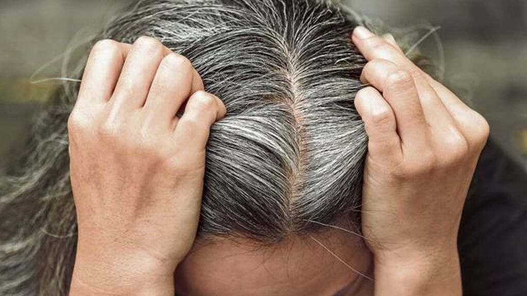 Lo más probable es que después del estrés, el pelo vuelva a su normalidad.